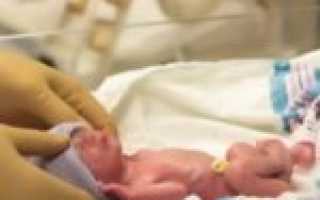 Методы лечения молочницы во рту у новорожденного