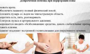 Неотложная помощь при перфорации язвы желудка — алгоритм доврачебных манипуляций