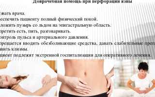 Неотложная помощь при перфорации язвы желудка — алгоритм доврачебных манипуляций