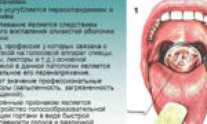 Поражение слизистой горла молочницей