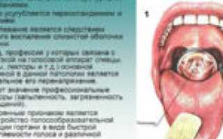 Поражение слизистой горла молочницей