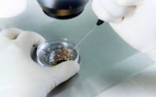 Преимплантационная генетическая диагностика: особенности ПГД