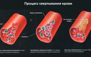 Заболевания крови: симптомы и лечение у взрослых и детей
