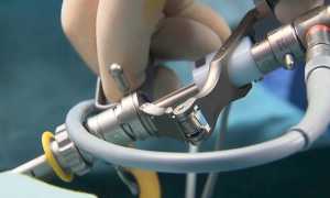 Показания к операции при аденоме простаты и способы хирургического лечения