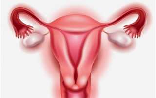 Что такое интактная матка и как ее лечить?