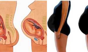 Повышенная температура перед родами