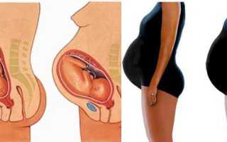 Повышенная температура перед родами