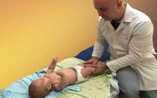 Упражнения при вальгусной деформации стопы у детей — как выполнять