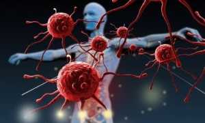 Причины появления и методы лечения грибка на локтях