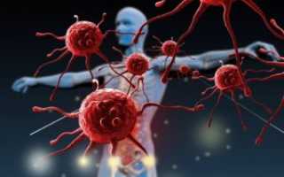 Причины появления и методы лечения грибка на локтях