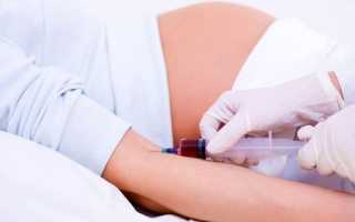 Что дает анализ на уродство при беременности?