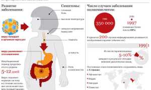 Прививка от полиомиелита: виды, инструкция, реакция у детей, отзывы