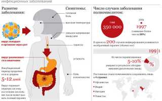 Прививка от полиомиелита: виды, инструкция, реакция у детей, отзывы