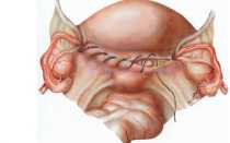 Что такое культя шейки матки после удаления матки?