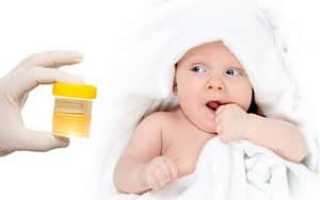 Как пользоваться мочеприемником для мальчиков новорожденных