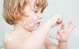 Каламин при ветрянке — инструкция по применению, форма выпуска и противопоказания