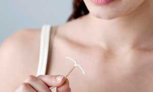 Последствия внематочной беременности — признаки и факторы риска развития осложнений