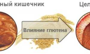 Целиакия у детей