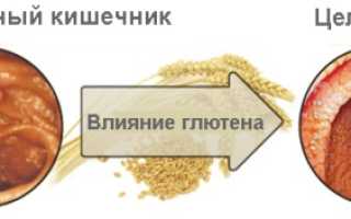 Целиакия у детей