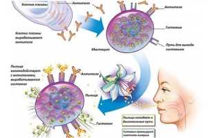 Симптомы аллергического ринита у взрослых — признаки и формы
