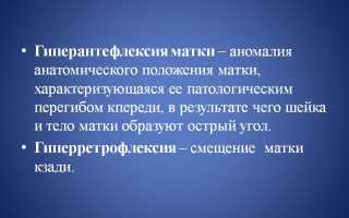 Что такое гиперантефлексия матки?