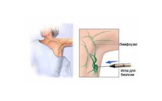 Боль в подмышке: причины и лечение