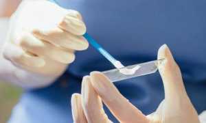 Лейкоциты в мазке у женщин — норма и причины повышенных значений