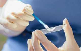 Лейкоциты в мазке у женщин — норма и причины повышенных значений