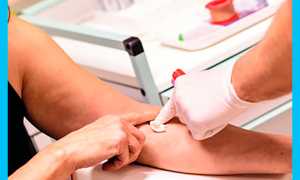 Идеальное соотношение ЛГ и ФСГ: норма в таблице