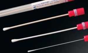 Стрептококк spp в мазке