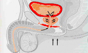 Особенности питания при лечении уреаплазмы