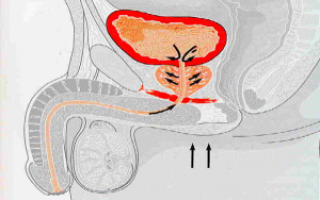 Особенности питания при лечении уреаплазмы