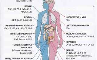 Что такое онкомаркер рака шейки матки?