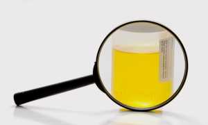 Анализ мочи по Сулковичу