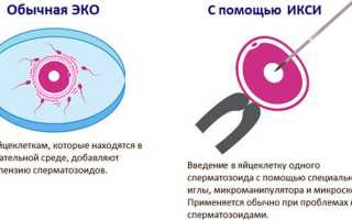 Процедура ПИКСИ: особенности оплодотворения