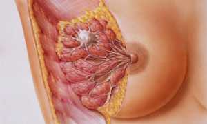 Диффузная фиброзная, кистозная и железистая мастопатия молочных желез