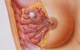 Диффузная фиброзная, кистозная и железистая мастопатия молочных желез