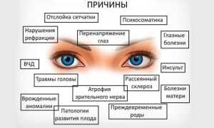 Диплопия глаза — причины развития, симптомы и лечение