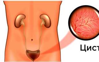 Жжение в мочевом пузыре у мужчин