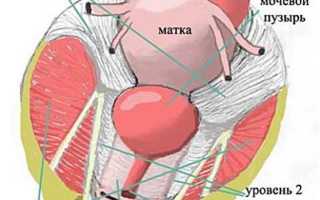 Латеропозиция матки: причины возникновения и лечение