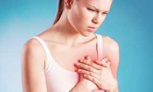 Синусовая брадиаритмия