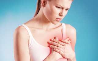 Синусовая брадиаритмия