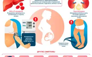 Токсикоз при беременности