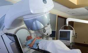 Лучевая терапия