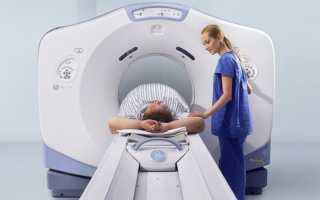 Диагностика цирроза печени: методы и анализы