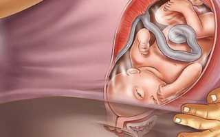 Когда должно произойти раскрытие шейки матки, что делать если этого не случилось?