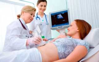 Вредно ли УЗИ при беременности для плода?