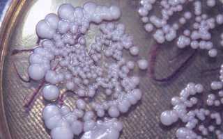 Дрожжевые грибы в кале у взрослого: симптомы и лечение