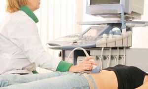 Первое УЗИ при беременности — на каком сроке делают, подготовка исследования и результаты