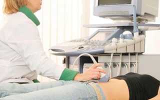 Первое УЗИ при беременности — на каком сроке делают, подготовка исследования и результаты